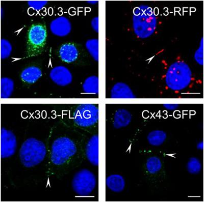 GJB4 variants linked to skin disease exhibit a trafficking deficiency en route to gap junction formation that can be restored by co-expression of select connexins